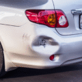 Best Dent Puller for Small Dents : A comprehensive Comparison